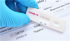 Thủ tục nhập khẩu Test Nhanh Covid 19 Thủ tục nhập khẩu Test Nhanh Covid 19