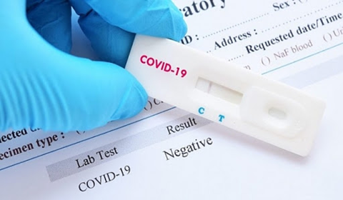 Thủ tục nhập khẩu Test Nhanh Covid 19 Thủ tục nhập khẩu Test Nhanh Covid 19